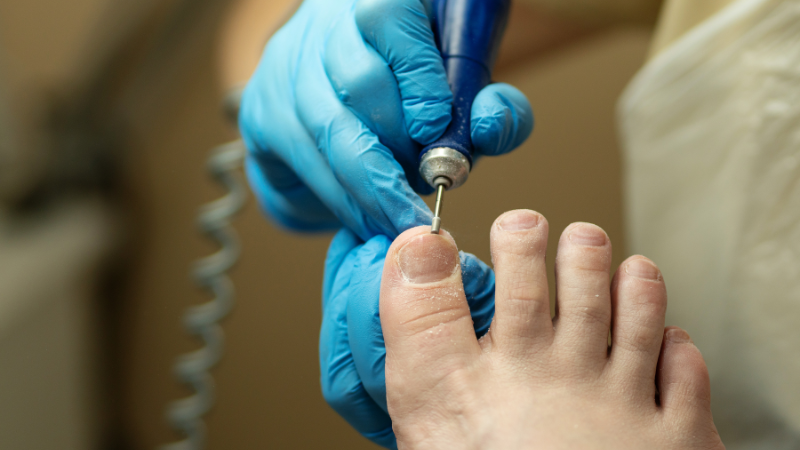 Trim Your Toenails Correctly
